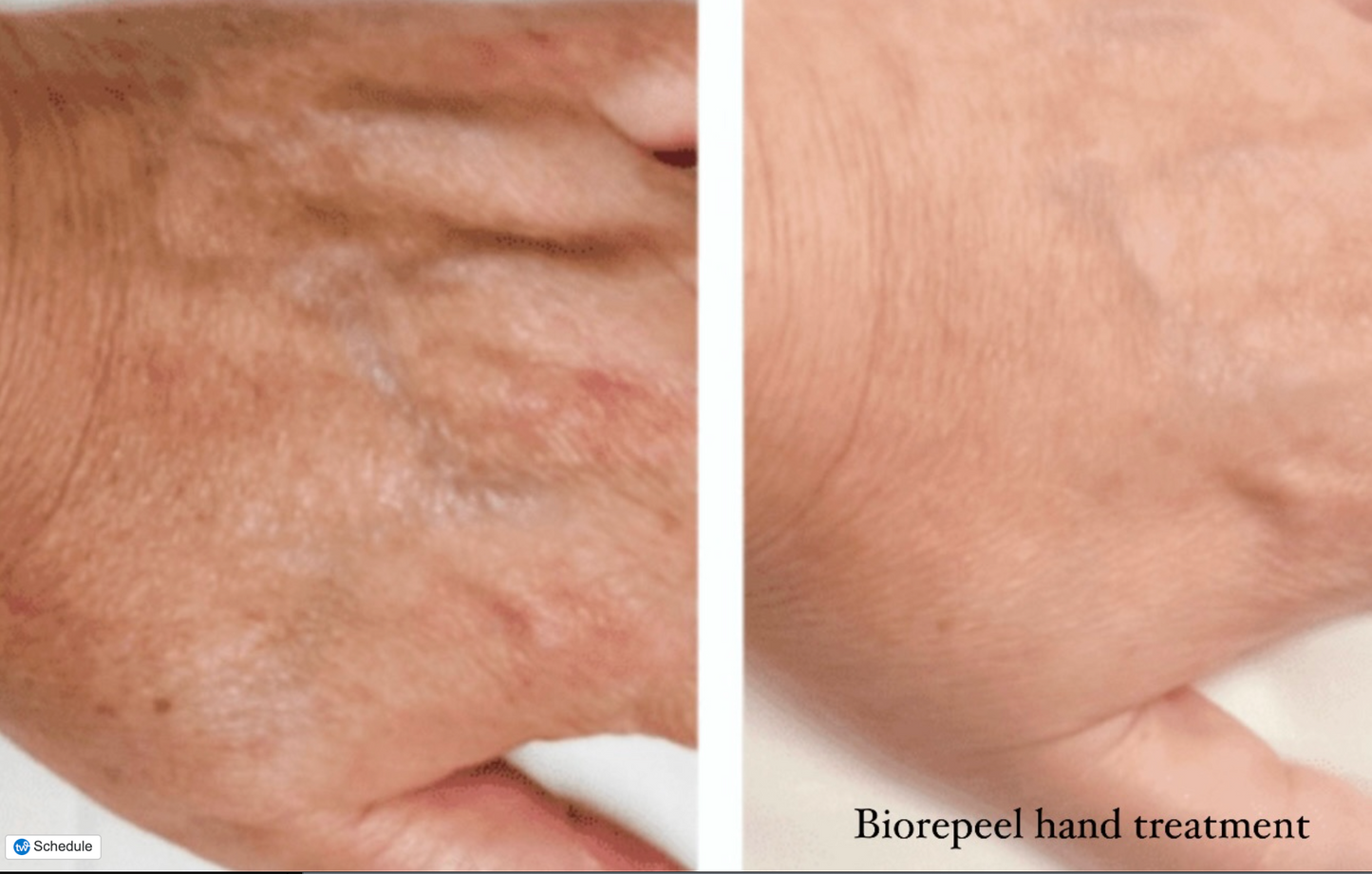 Hands Gracefully Renewed
