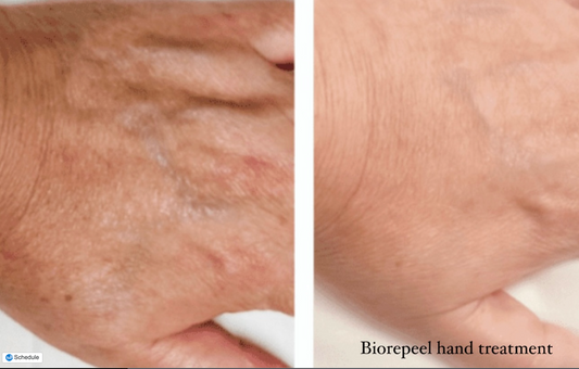 Hands Gracefully Renewed